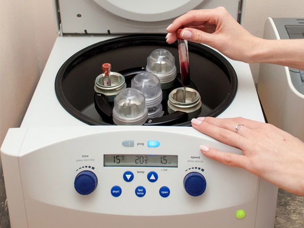 Face - Platelet Rich Plasma (PRP)