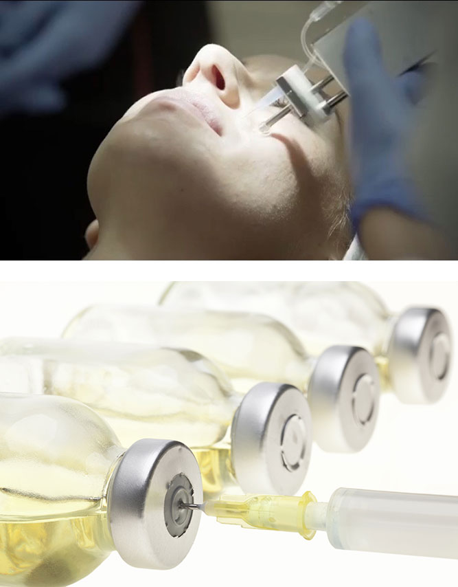 MESOTHERAPY OR PRP FOR DARK CIRCLES? The London Facial Care