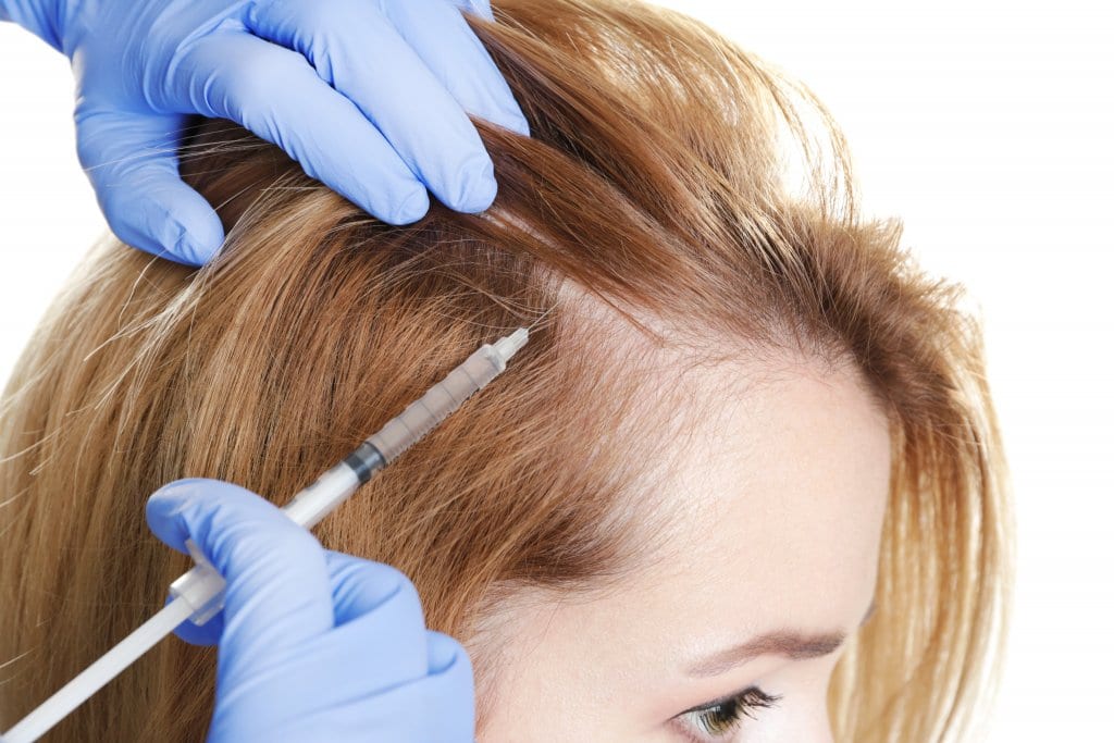 TIPS FOR HAIR REGROWTH IN COMBINATION WITH PRP TREATMENT The London