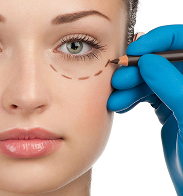 UNDER EYE REJUVENATION WITH TEOSYAL REDENSITY II