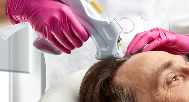 DOES PRP WORK FOR HAIR LOSS ?