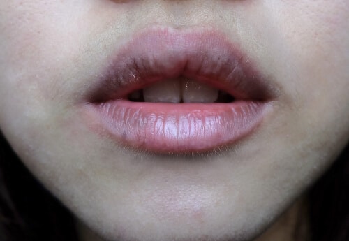 SIGNS OF SMOKER'S LIPS: DARK LIPS AND WRINKLES