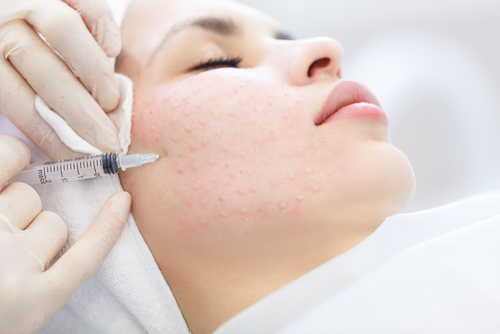 HOW LIP TREATMENTS REVITALISE SMOKER'S SKIN