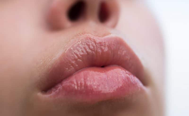 THE BEST LIP FILLER TREATMENT IN LONDON TO ACHIEVE VOLUPTUOUS AND NATURAL LIPS!