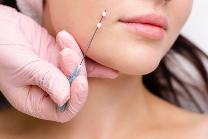 An Evolution of the FaceLift