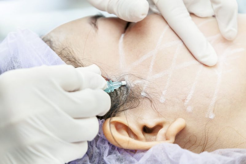 Ensuring Surgical Excellence