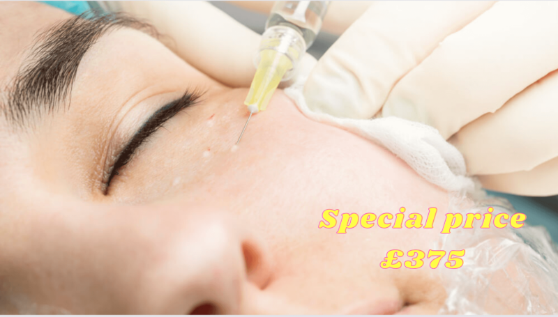 PRP UNDER EYES